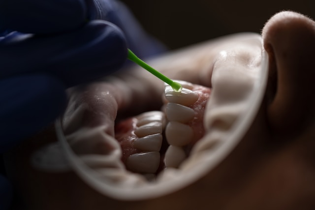 clinica dental en chiriqui